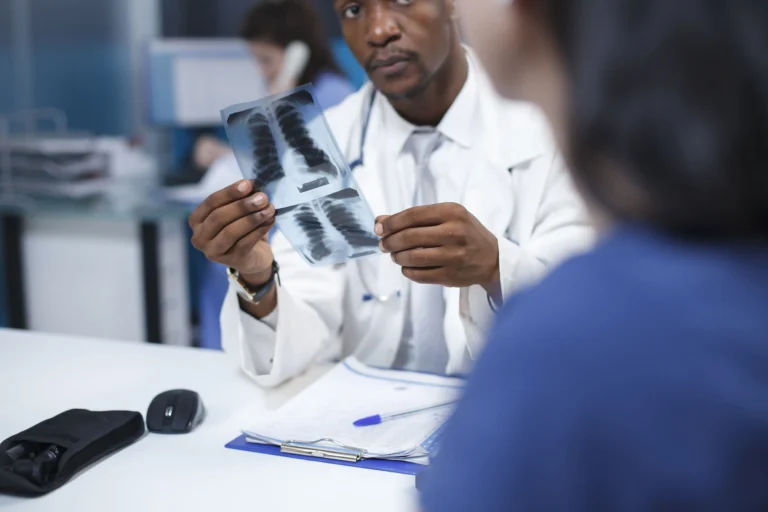 Médico analisando radiografia de pulmão para discutir sotorasibe com paciente